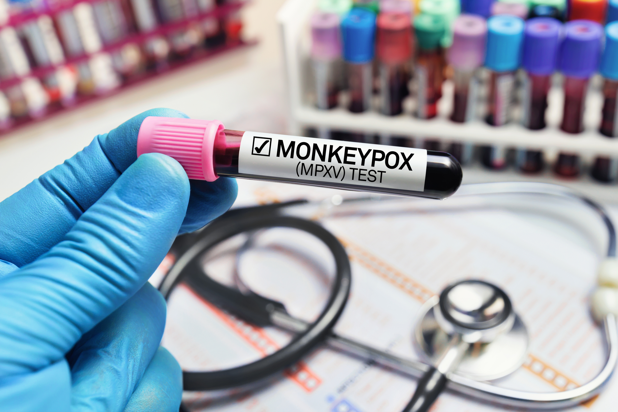 OMS a declarat focarul de variola maimuței o urgență globală de sănătate publică